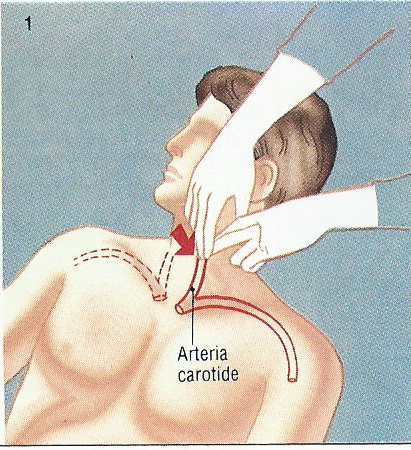 Come trattare varicosity cosmetico